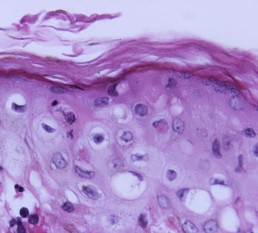 Image from CDC/Dr R B Haraszti