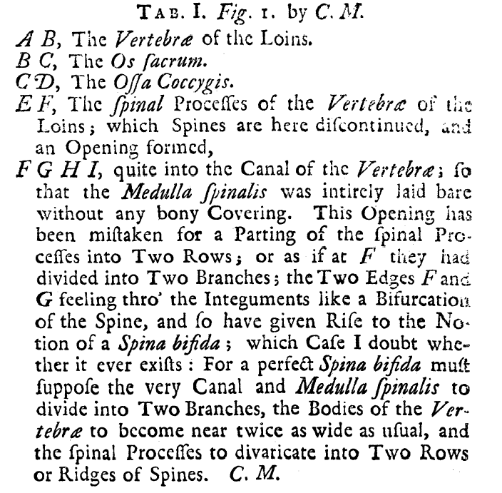 Editorial comments on report from George Aylett in the 1740s about spina bifida