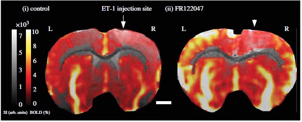Maps of BOLD signal changes in rat brains