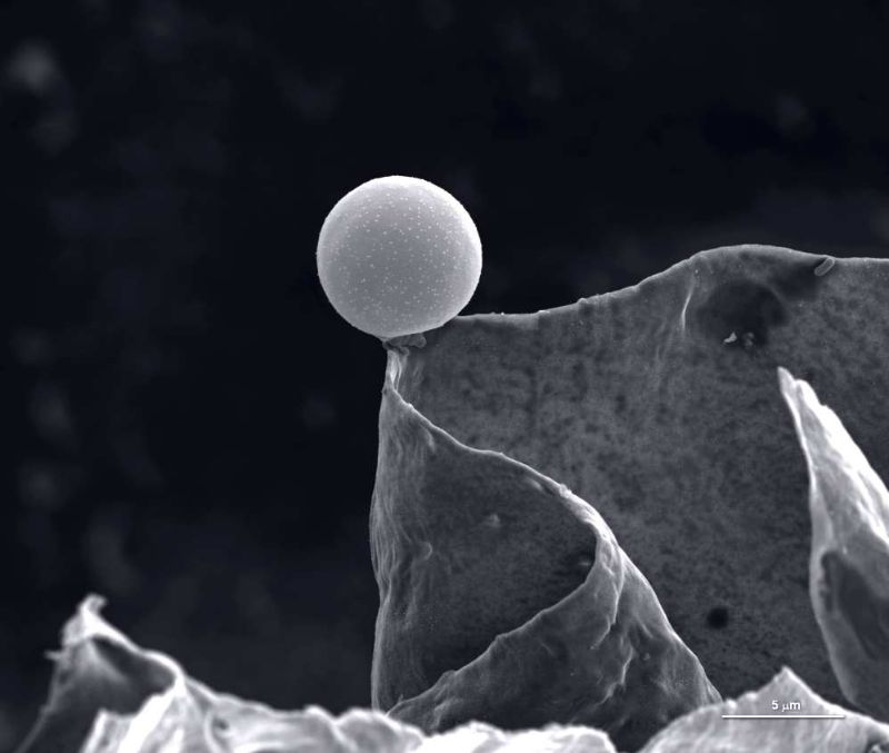 María Carbajo Sánchez: In balance – Winner: Micro imaging