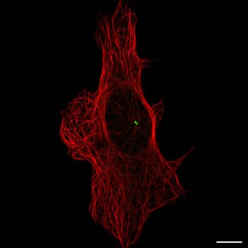 Staining of centrosome in human cell line U-2 OS