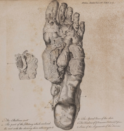 Drawing of the left foot of Norfolk’s Mummy
