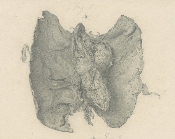 Drawing of the heart of Granville's mummy