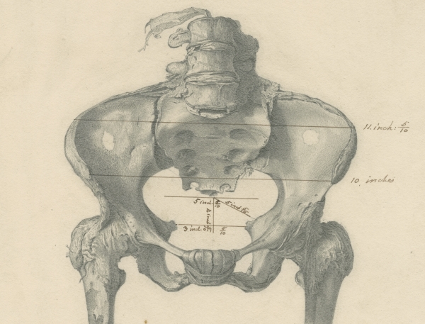 Drawing of the pelvis of Granville's mummy