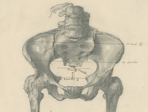 Ancient autopsy | Royal Society