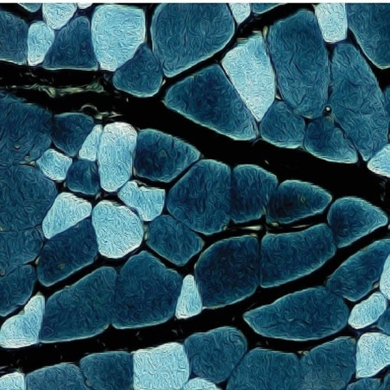Histological section of a tufted capuchin monkey MHC profile (negative image) unmasks the remarkable diversity and flexibility of contractile properties in primate chewing muscles. Credit: Andrea Taylor and Lauren Taylor. See ‘The influence of jaw-muscle fibre-type phenotypes on estimating maximum muscle and bite forces in primates’ by Holmes M, Taylor AB in this issue. (https://doi.org/10.1098/rsfs.2021.0009)