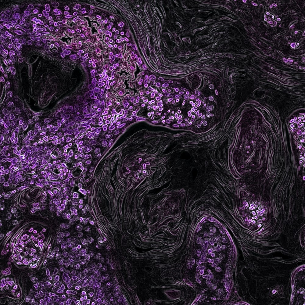 Photo by National Cancer Institute on Unsplash. Kras-Driven Lung Cancer. Created by Eric Snyder, 2015.