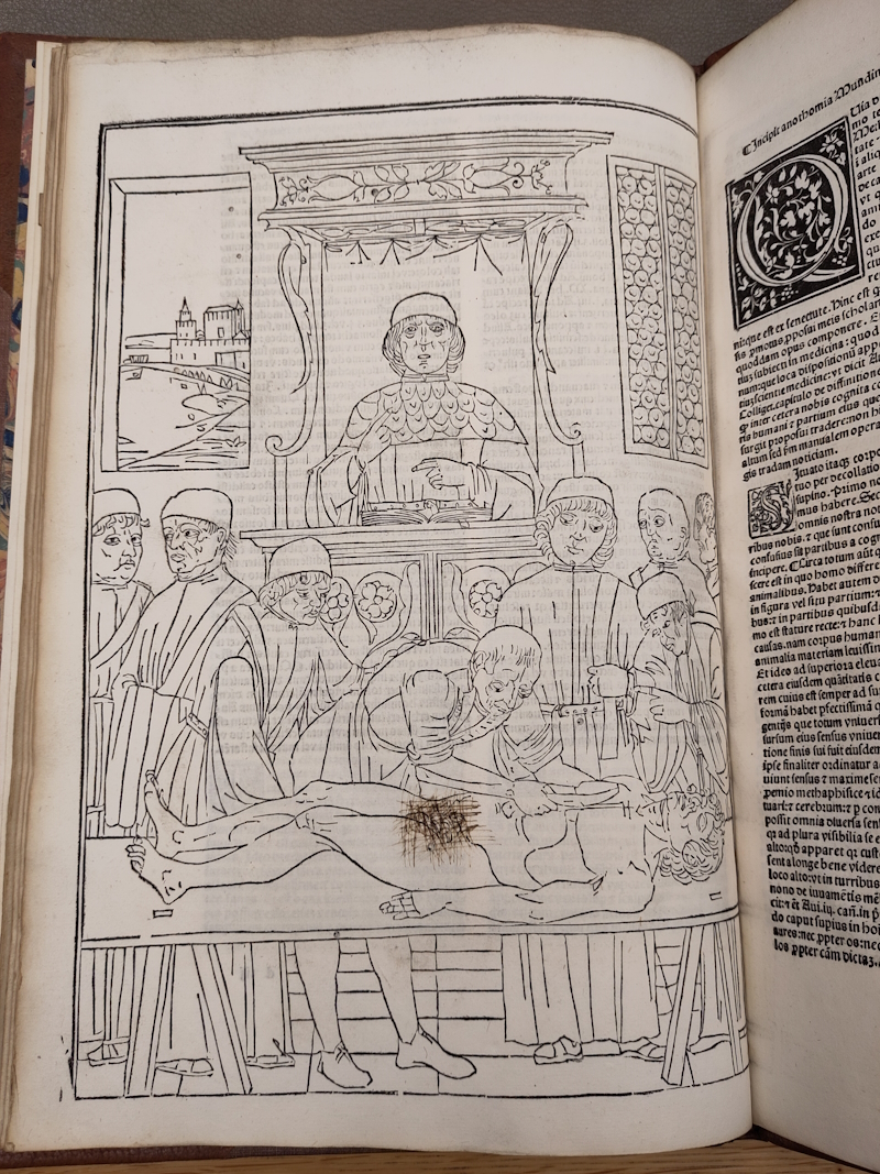 Page from John Ketham 'Fasciculus medicinae' (1500)