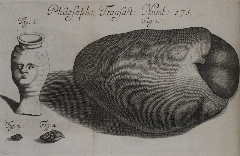 A bladder stone, a clay urn, and shells found in the kidney of a woman, 1685