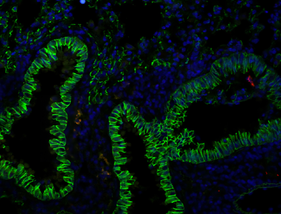Fluorescent imaging of M. tuberculosis (red) entering the airways (green).