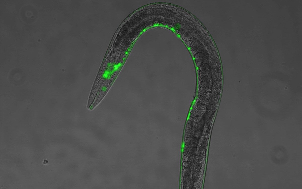 Caenorhabditis elegans nematode under a microscope