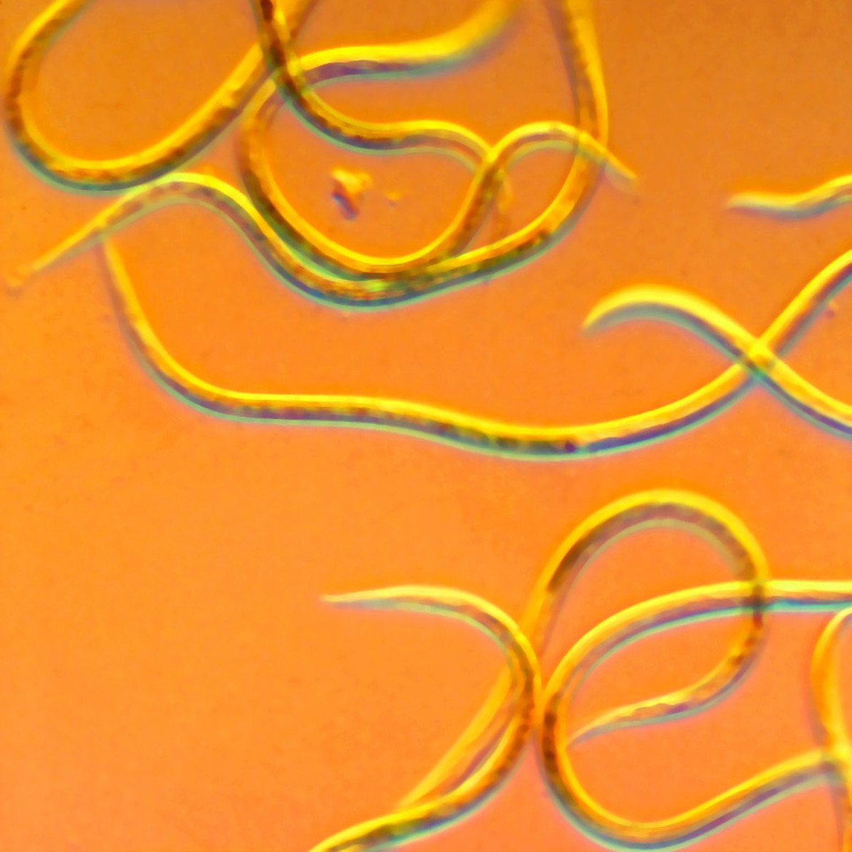parasite under microscope