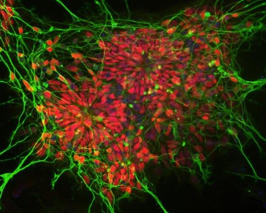 Human cortical neurons in a dish. Credit: Dr Sarah Newey, Dorothy Hodgkin Fellow from the University of Oxford.