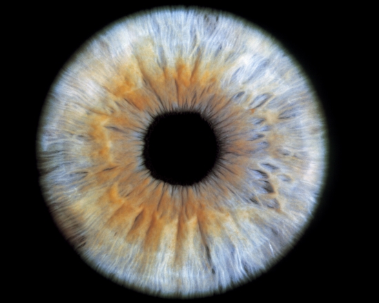 Computer-enhanced blue/grey iris of the eye