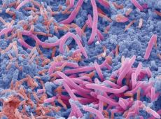 Microbes