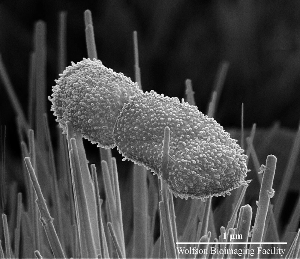 Bacteria on a bed of nanospikes.