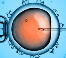 Cell injection