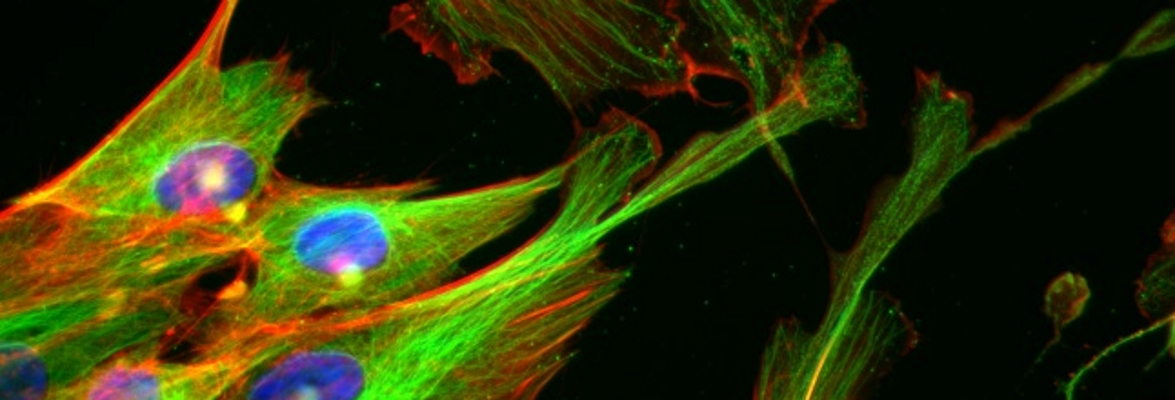 Cells sensing the nanoscale environment' Cell cytoskeletons (tubulin = green, actin = red) and nuclei (blue), credit: Professor Matthew Dalby,  University of Glasgow