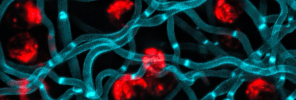 Human immune cells (red) interacting with the fungus Candida albicans. Fungal infections kill more people worldwide than malaria. Credit: Jude Bain, Aberdeen Fungal Group