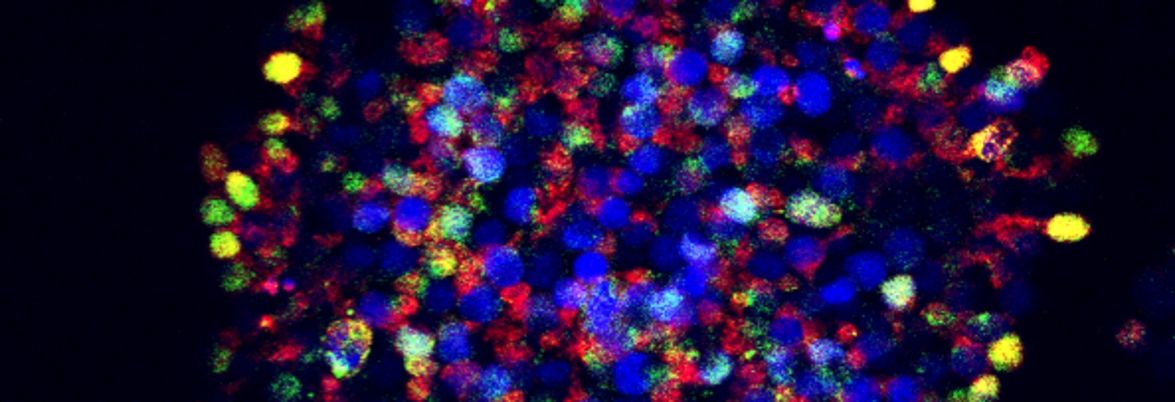 Via step-wise reprogramming, adult cells can be transformed to stem cells, which again have the ability to develop into other specialised human cell types. The image shows a colony of these stem cells and the colours represent markers that confirm that they have successfully been reprogrammed. Credit: Babraham Institute