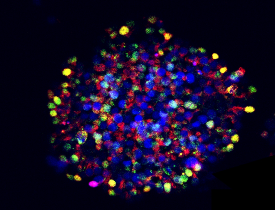 Via step-wise reprogramming adult cells can be transformed to stem cells, who again have the ability to develop into other specialised human cell types. The image shows a colony of these stem cells and the colours represent markers that confirm that they have successfully been reprogrammed. Credit: Babraham Institute