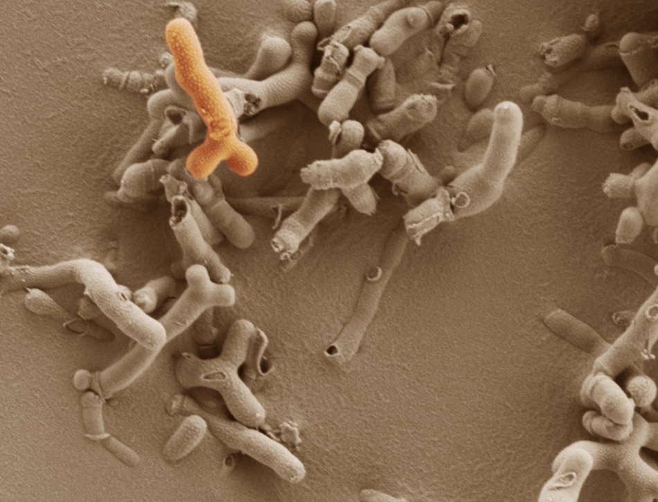 The image shows the beneficial gut microbe Bifidobacterium breve. These are found at high levels in breast-fed infants. The presence of Bifidobacterium at birth (and throughout early life) largely impacts the wider bacterial ecosystem leading to a 'healthy' microbiota that can be maintained into adulthood. Credit: Kathryn Cross, Quadram Institute