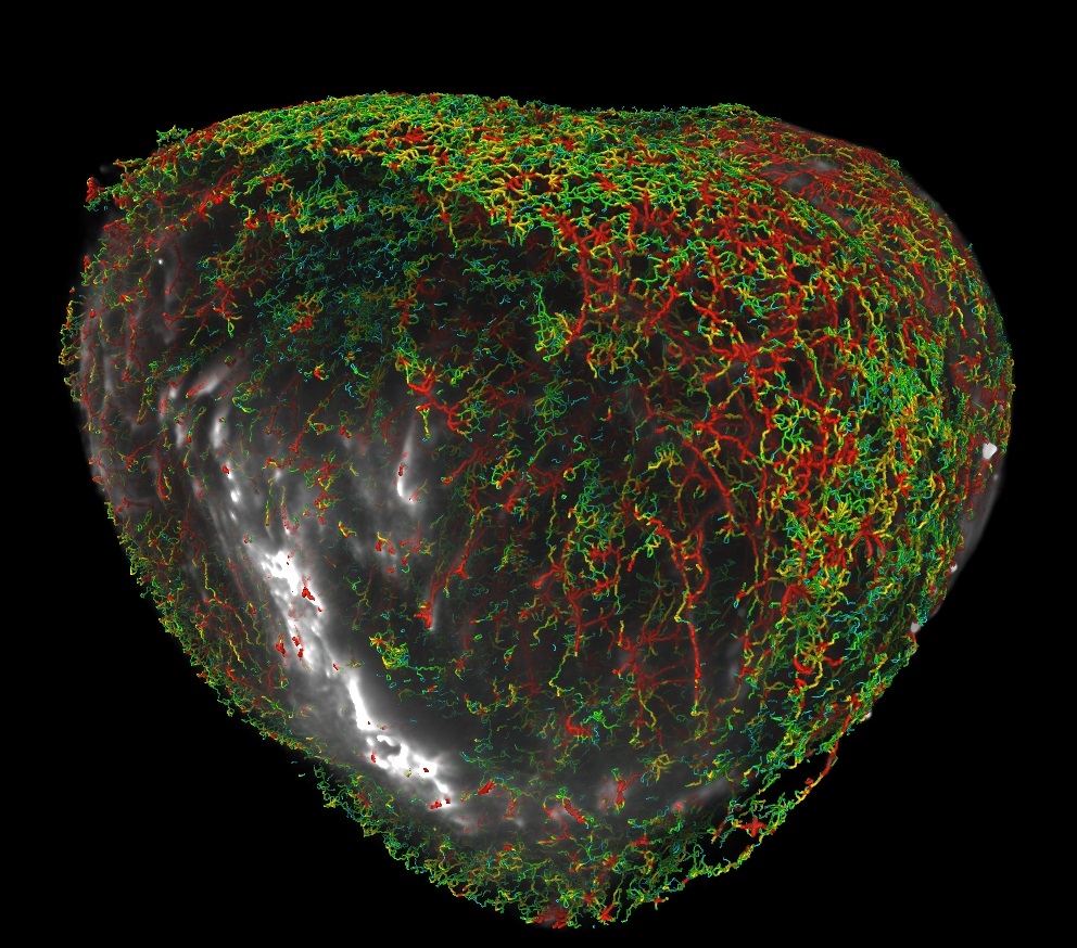 A 3D virtual reconstruction of a cancerous tumour and its surrounding blood vessels made using high-resolution imaging.