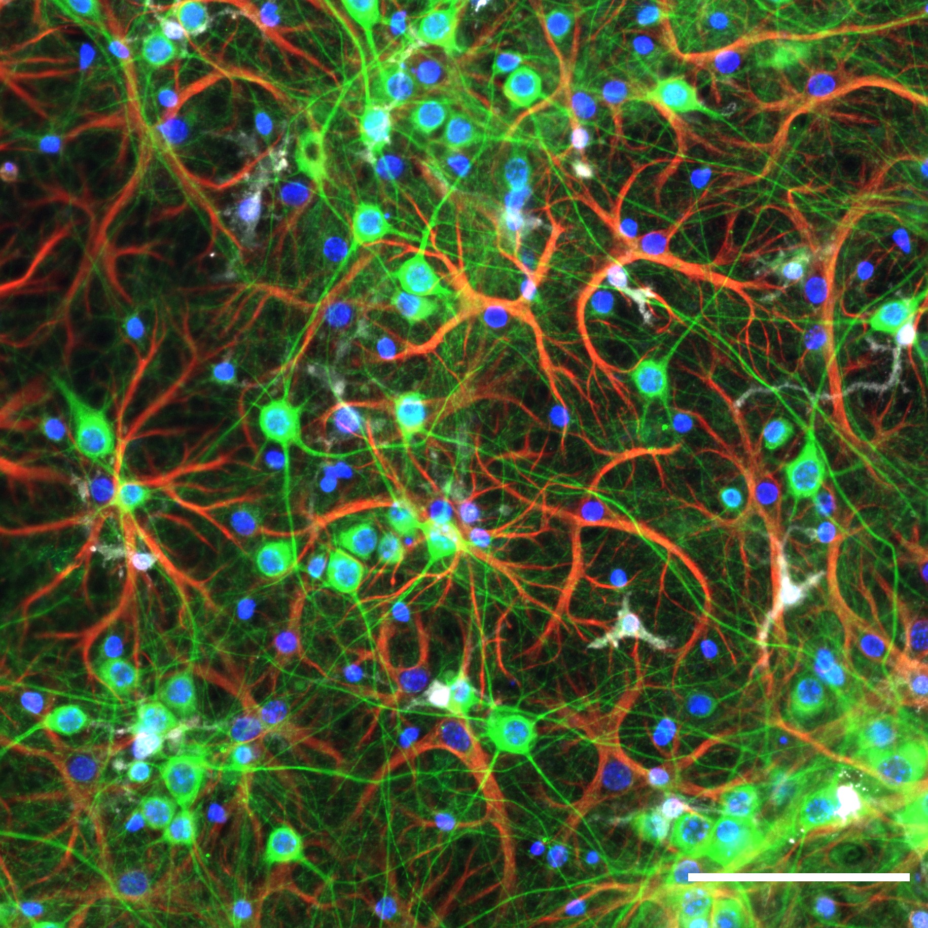 Neurons under fluorescence 