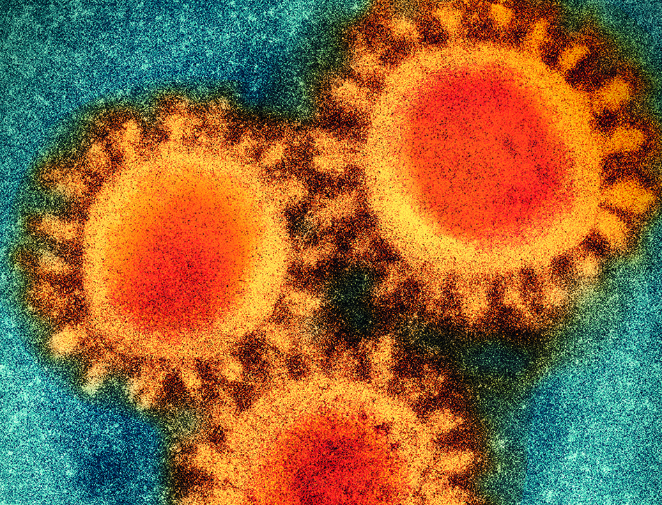 Coloured visualisation of electron microscopy photo of the SARS-CoV-2 virus.